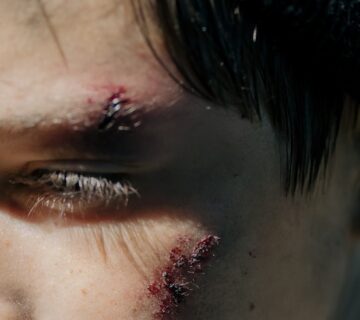 personal injury settlement amounts examples